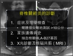 台湾青壮年下背痛，四成被误诊 - 中时电子报