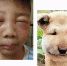 竹市运动场踢足球 学童被蜜蜂叮成麵包超人 - 中时电子报