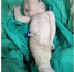印度妇人產下「美人鱼宝宝」 出生4小时夭折 - 中时电子报