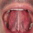 ６招口咽运动 轻松减轻「打鼾」症状 - 中时电子报
